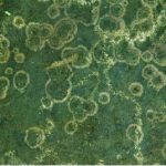 Lichen-microscope-vert